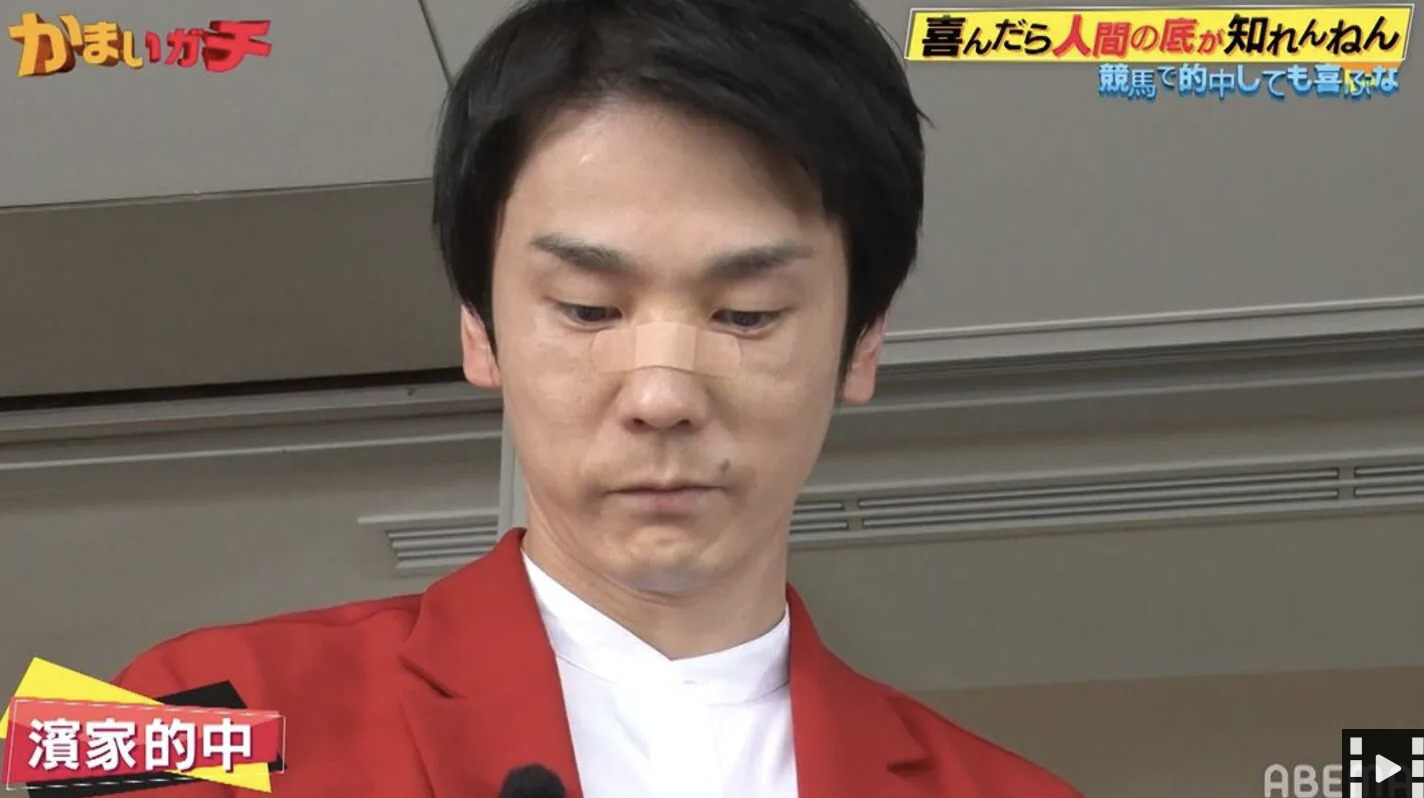 かまいたち濱家 鼻の絆創膏理由3選 ネタにしない理由は番組 芸能速報 Kattan かまいたち濱家 鼻の絆創膏理由3選 ネタにしない理由は番組 芸能速報 Kattan