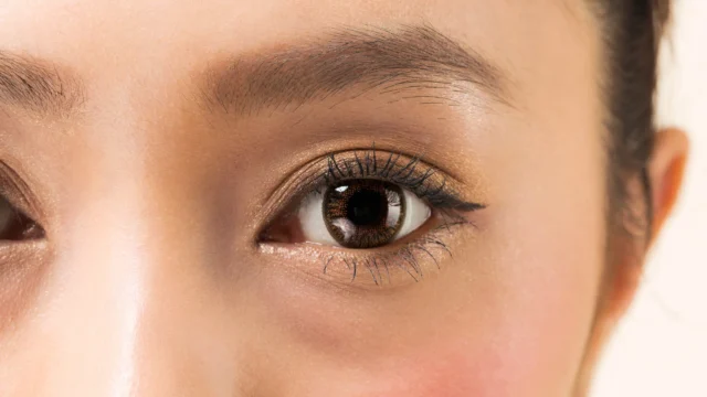 二重整形している人の見分け方ってある？整形のメリット・デメリットは？